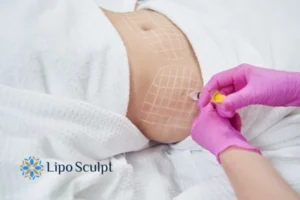 Are The Results From Aqualyx Permanent? 1 Do you want to know how long Aqualyx High Wycombe results last?