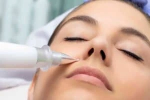 Best Actinic Keratoses Removal 3 Actinic keratoses High Wycombe solutions - book in today!